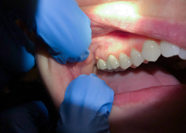 Best Emergency Dental Surgery in Union City, PA